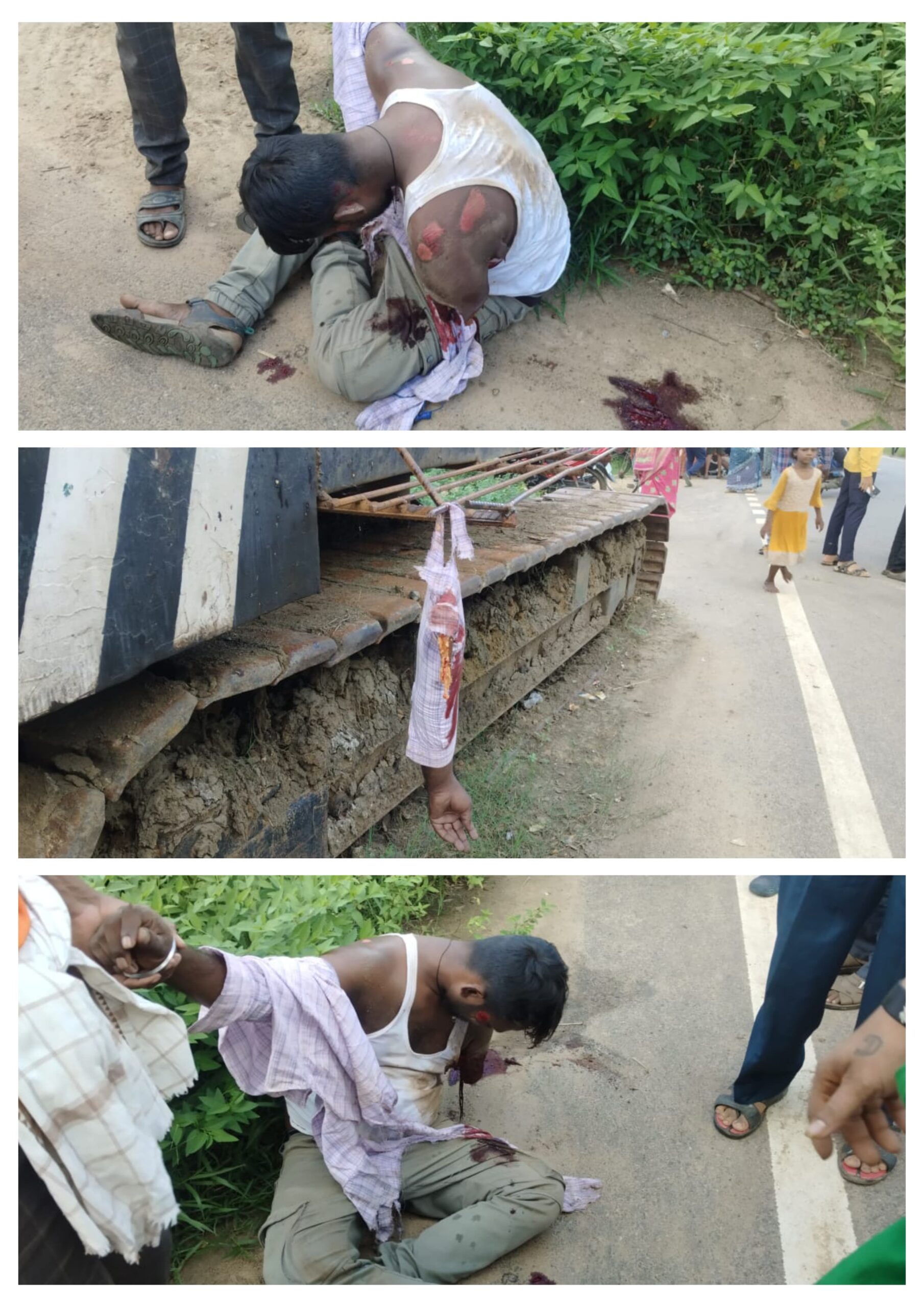 ମୋଟରସାଇକେଲ ଦୁର୍ଘଟଣାରେ ଶରୀରରୁ ଛିଣ୍ଡିଗଲା ହାତ।