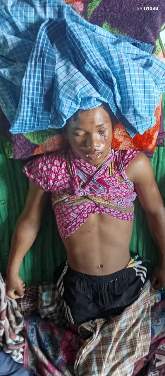 ଅବ୍ୟବସ୍ଥା ମଧ୍ୟରେ ଥିବା ହୋଷ୍ଟେଲରେ ଛାତ୍ର ପଡି ଗୁରୁତର ଘଟଣାକୁ ପାଖାପାଖି ସାତ ଦିନ ବିତିଗଲାଣି, ତଦନ୍ତରେ ଶୀଥିଳତା ଆଜି ମଧ୍ୟ ଚାଲିଛି ଚେରମୂଳୀ ଉପଚାର