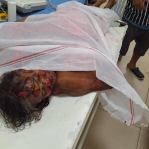 କାର୍ ଧକ୍କାରେ ମହିଳା ମୃତ